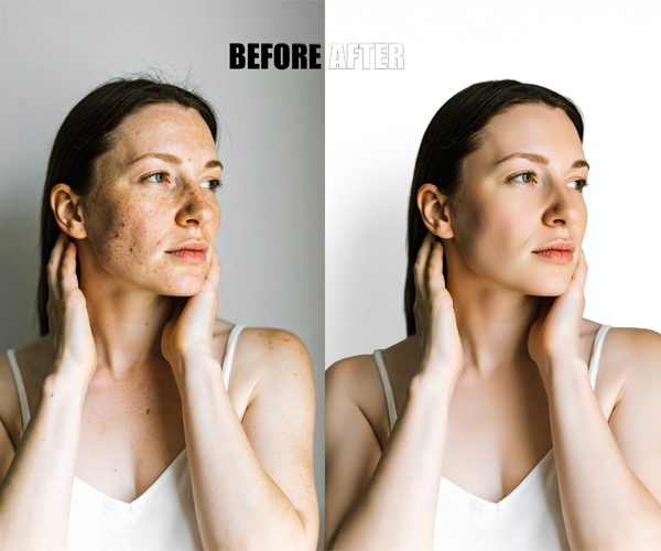 Diamond Ring Before/After